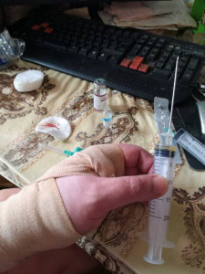 так мы справляемся пока сами с гноем гигромы запястного сустава