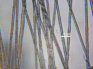 Кто использует маски для лица? - PICT0030 шкала 500 крат.jpg