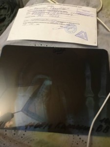 Это моя болячька