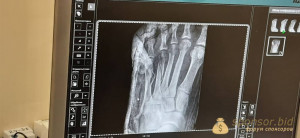 Помогите пожалуйста на операцию - 2_5469695174202362434.jpg