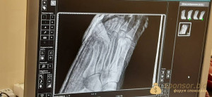 Помогите пожалуйста на операцию - 2_5469962041995299340.jpg