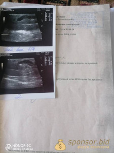 На операцию - IMG_20240211_114714.jpg