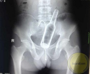 Помогите нужны деньги на троих детей - items_in_the_ass_bazara0_01_wm.jpg